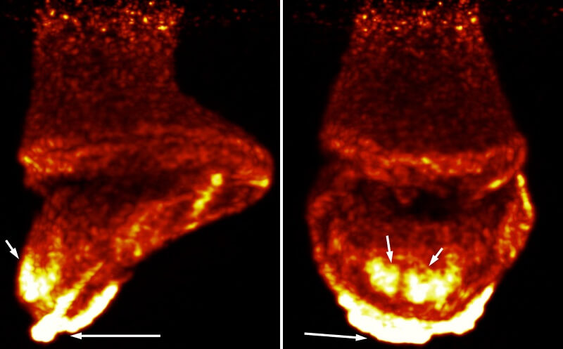 PET Imaging at UC Davis Continues Success