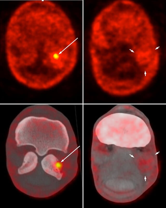 PET Imaging at UC Davis Continues Success